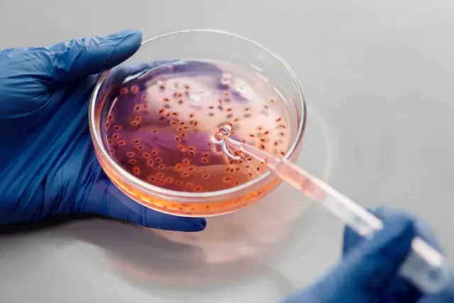 HPV 백신은 콘딜로마 및 관련 질환 예방에 효과적인 방법이다.
