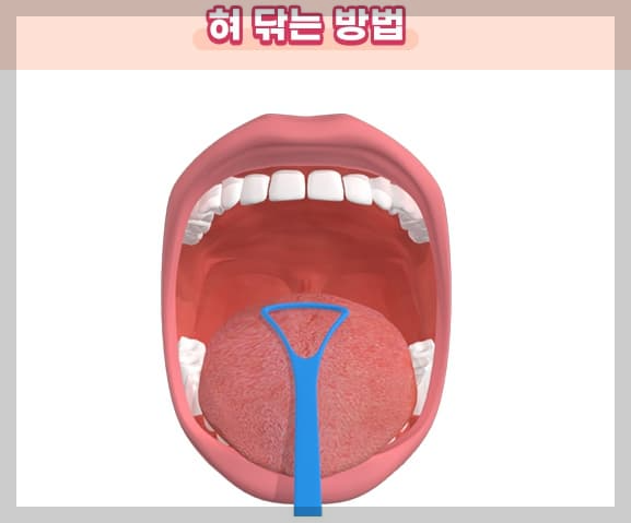 혀닦는-방법