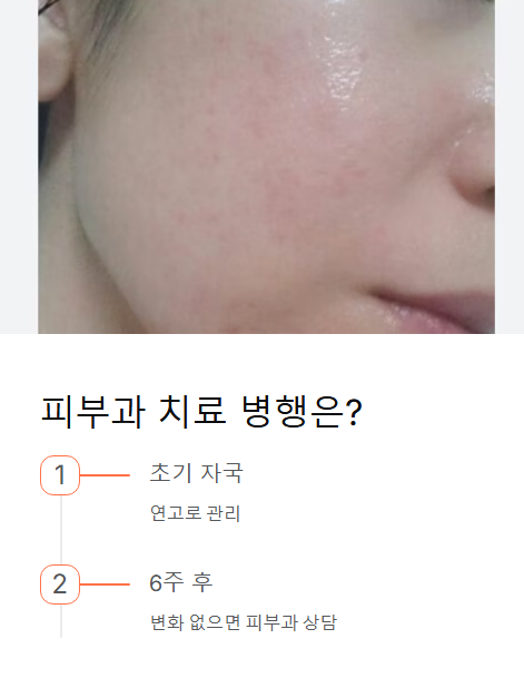 피부과 치료 병행은?
