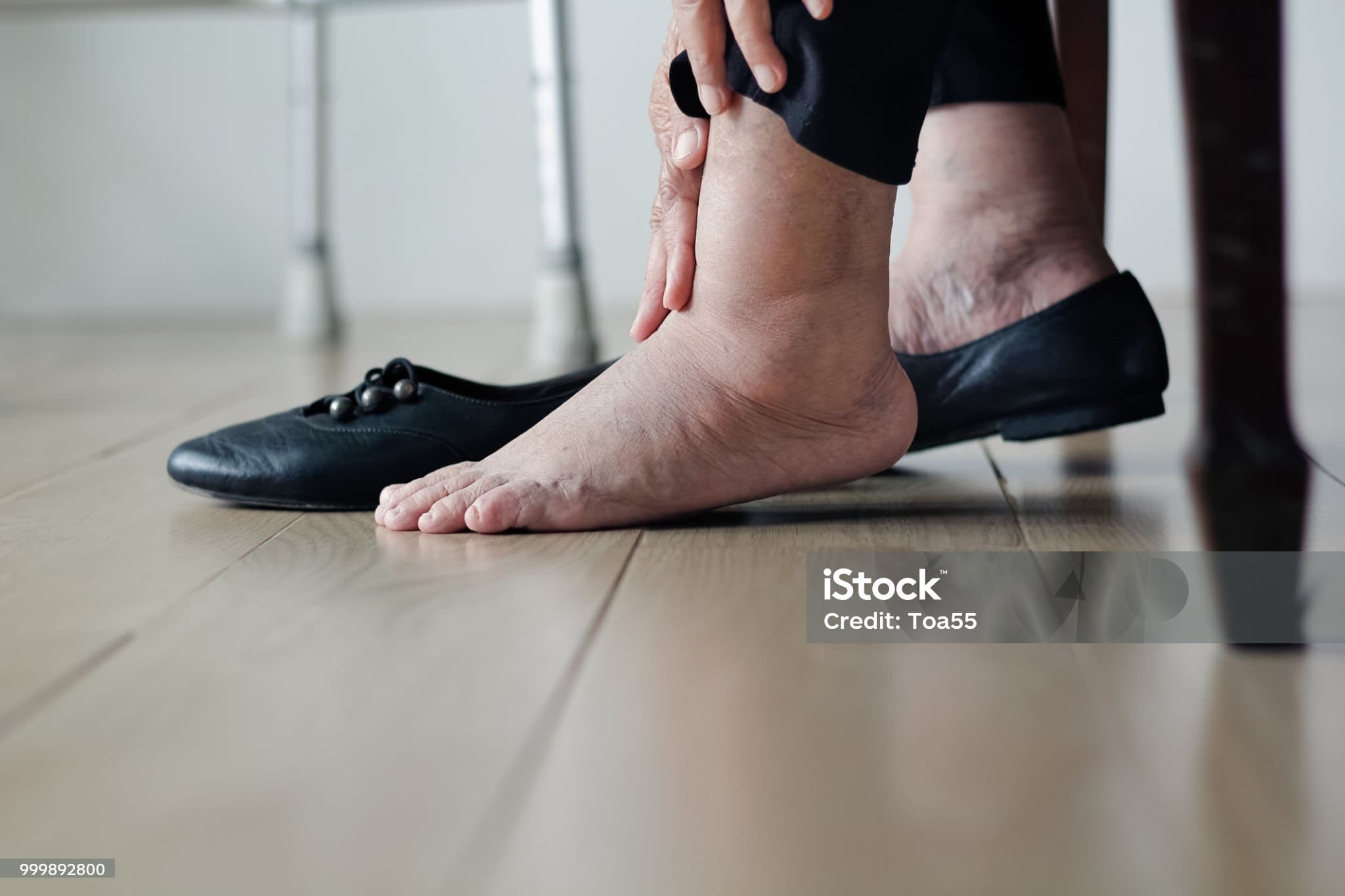 노인이다리가 퉁퉁 붓는 이유&amp;#44; 한쪽만 부을 때와 양쪽이 부을 때의 차이