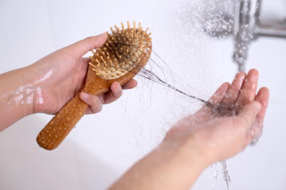 조기 발견이 최고의 예방법, 지금이 탈모 관리의 시작