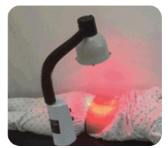 물리치료 적외선 조사기