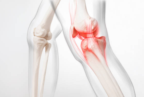 무릎 관절