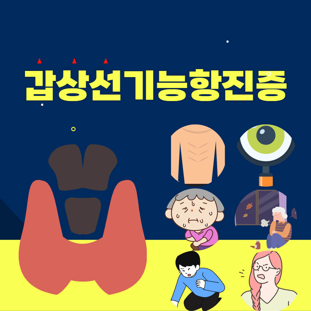 갑상선기능항진증