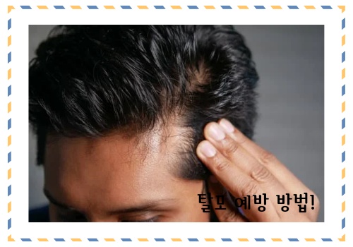 탈모 예방 방법 알아보고 예방