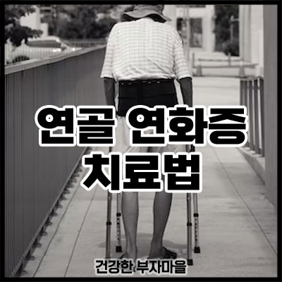 연골 연화증 치료법