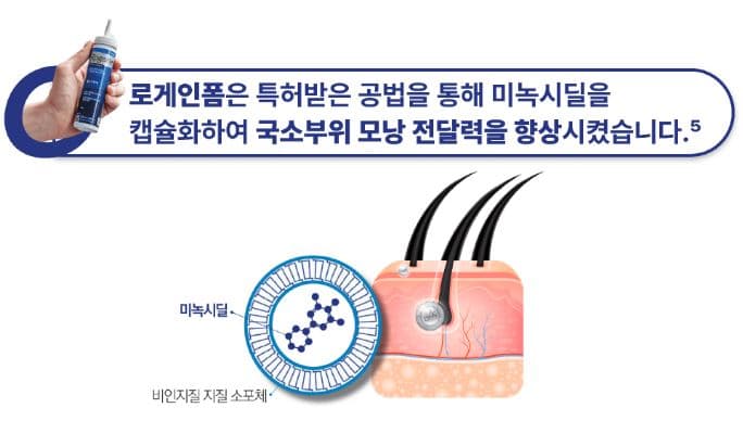 로게인폼 효과 효능