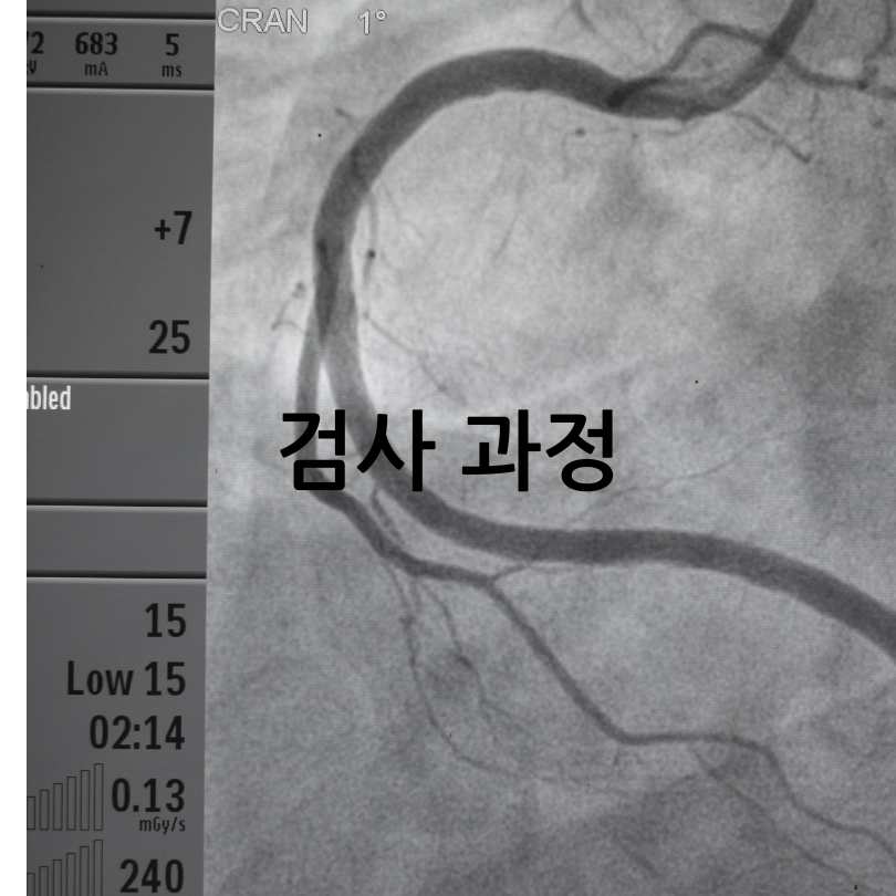 뇌혈관 조영술
