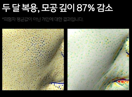 뮤르디-파이테론-효능