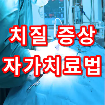 치질-증상-자가치료법-건강
