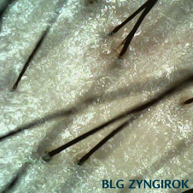 머리 중앙부 사진이다.