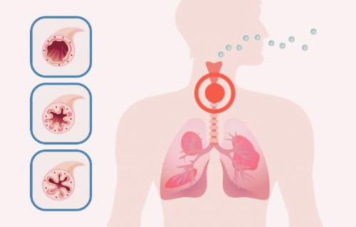 보스웰리아 효능 부작용