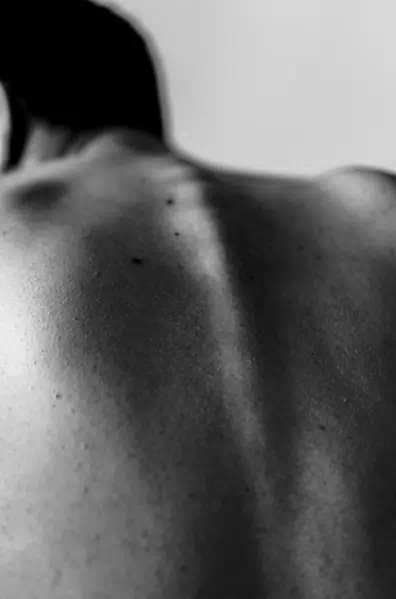 대상포진 초기증상 관련사진31