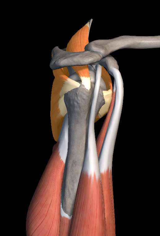 어깨 회전근개 파열 증상 원인 치료법
