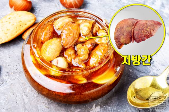 매일 꿀을 먹으면,꿀 한숟갈,동맥경화 지방간 꿀 효능,팁줌