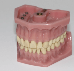 치과 마취 주사의 통증은 참을만한가요