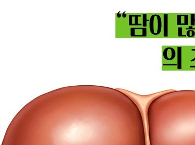 간경화 초기증상