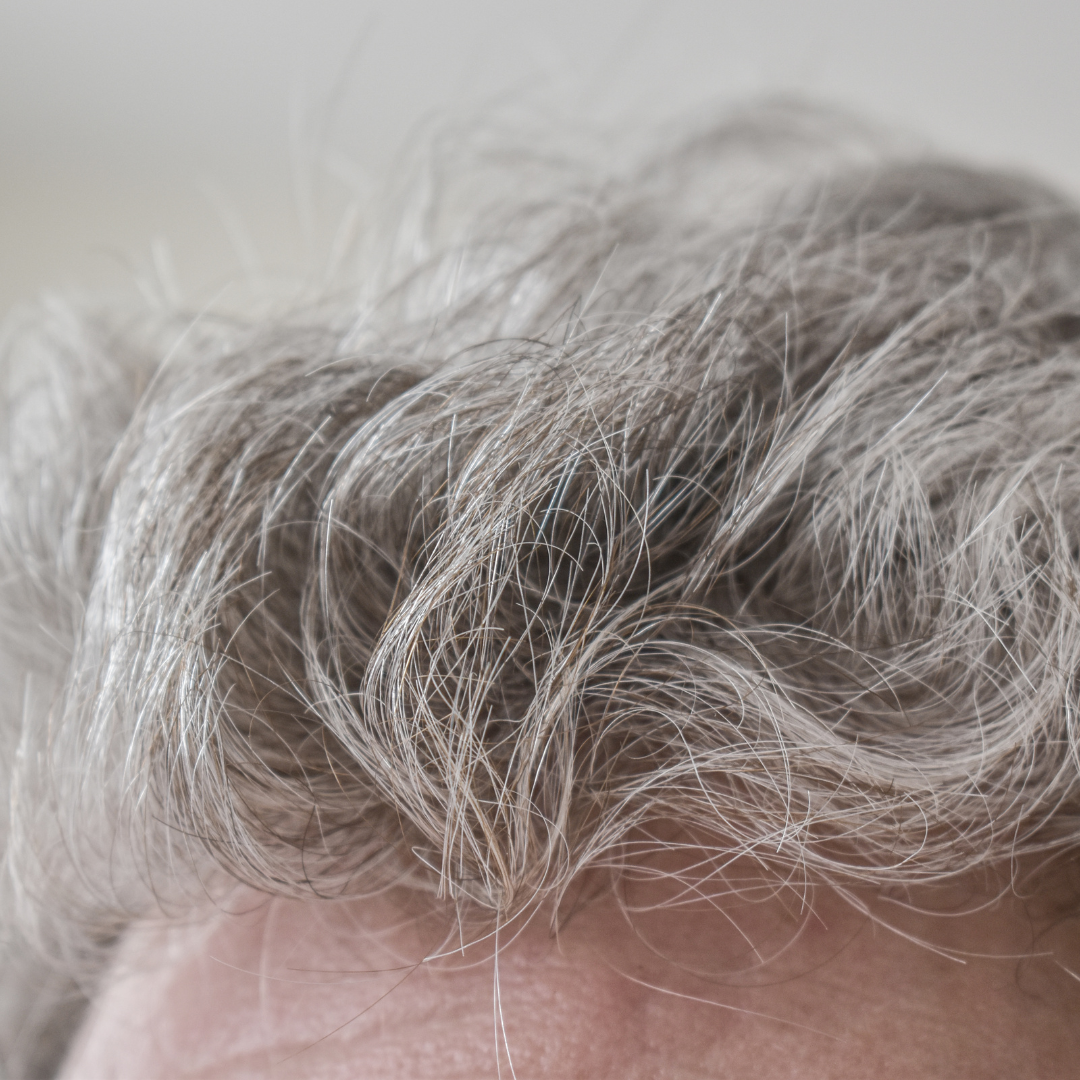 흰머리 나는 이유와 관리 방법&amp;#44; 효과적인 해결책