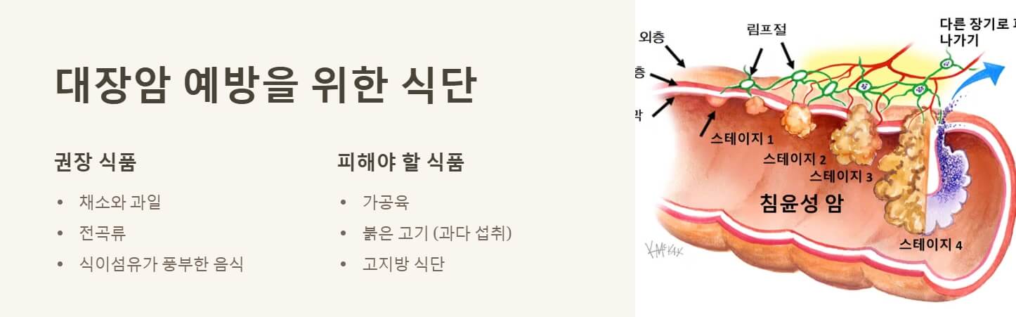 대장암 초기증상 및 검사방법