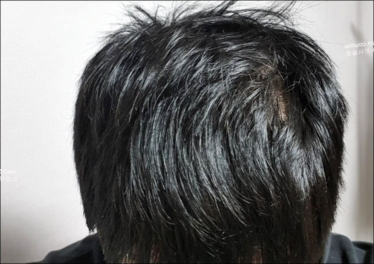 판시딜 복용 후기