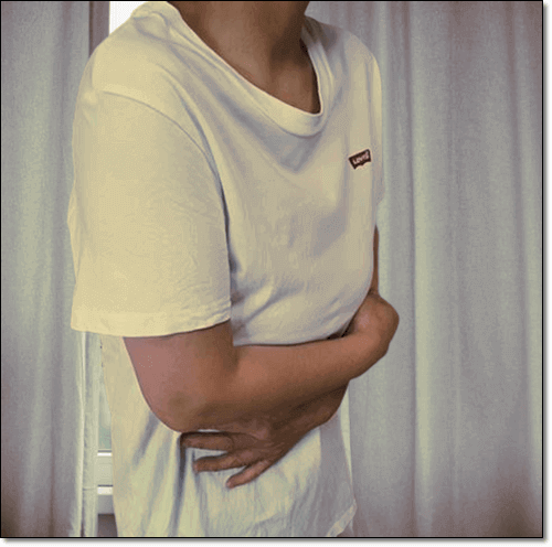 나보시안 낭종이 생긴 여성