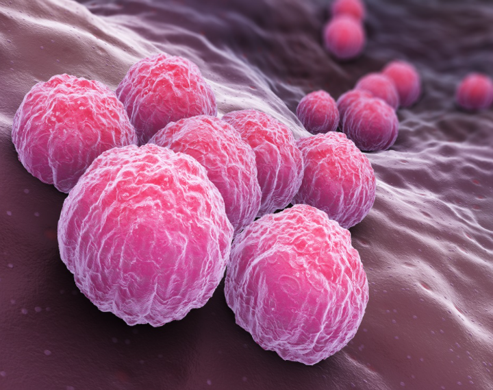 STD 12종 성병 검사