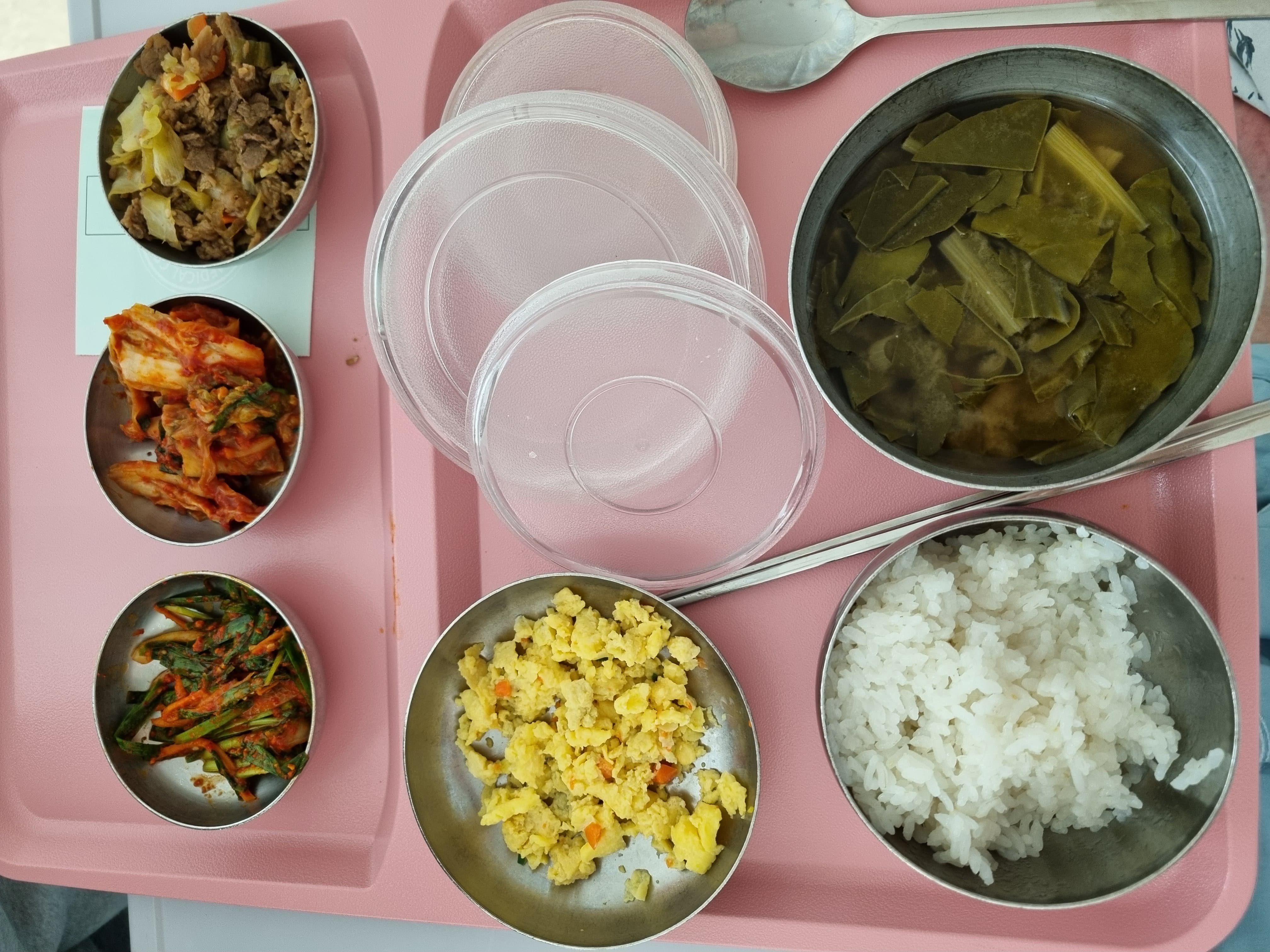 서울아산병원 부신정맥채혈 병원식사