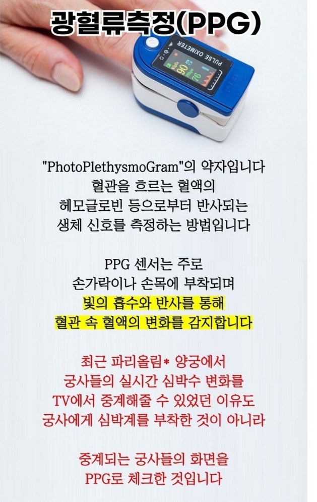 -뇌졸중-휴대용-심전도기기