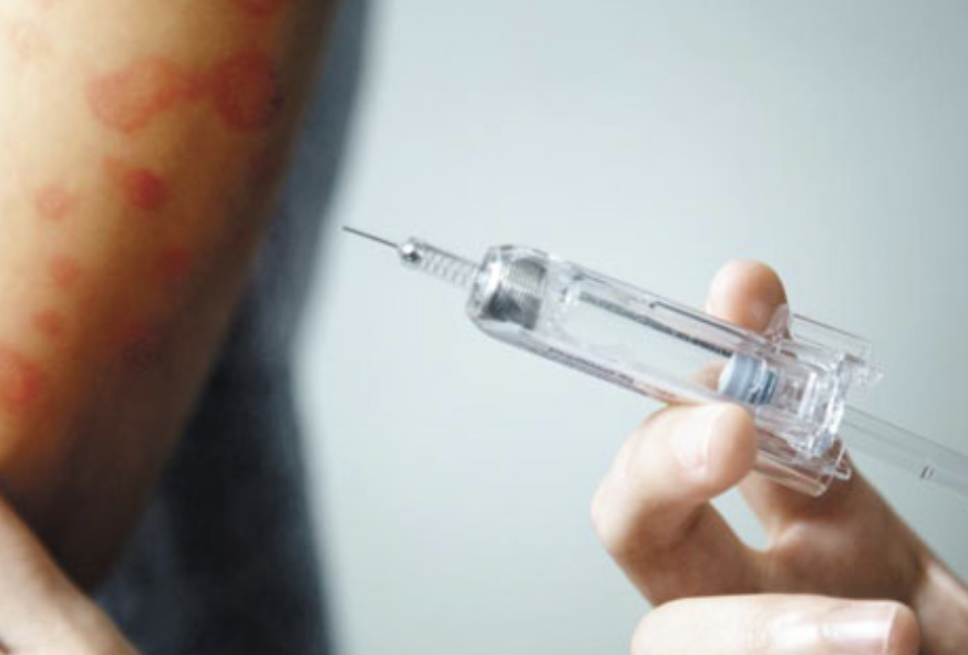 서울 무료 대상포진 예방접종 대상