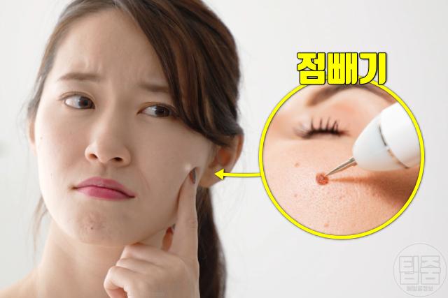 피부에 흰점 생기는 이유 점빼기 얼굴흰점 원인