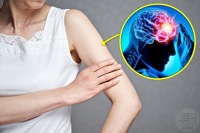 뇌종양 증상 한쪽 팔다리 힘빠짐