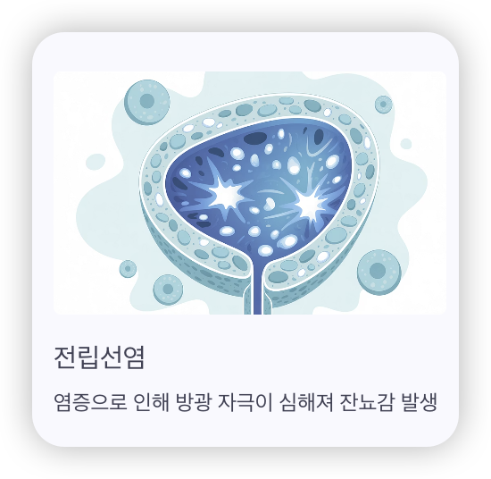 남성-잔뇨감-원인-전립선염