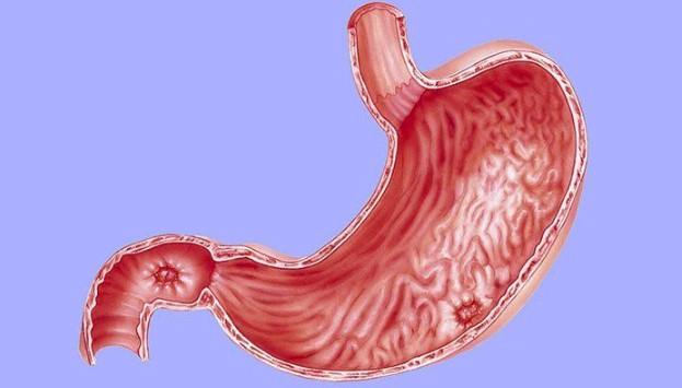헬리코박터균 자주 묻는 질문 FAQ