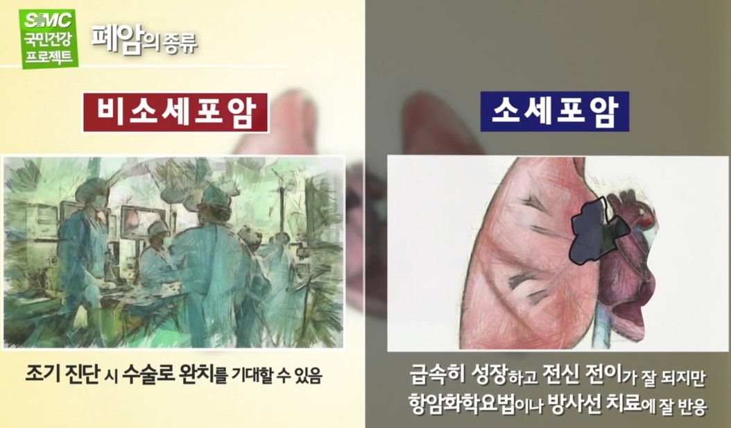 폐명의-임재준-교수-심태선-교수