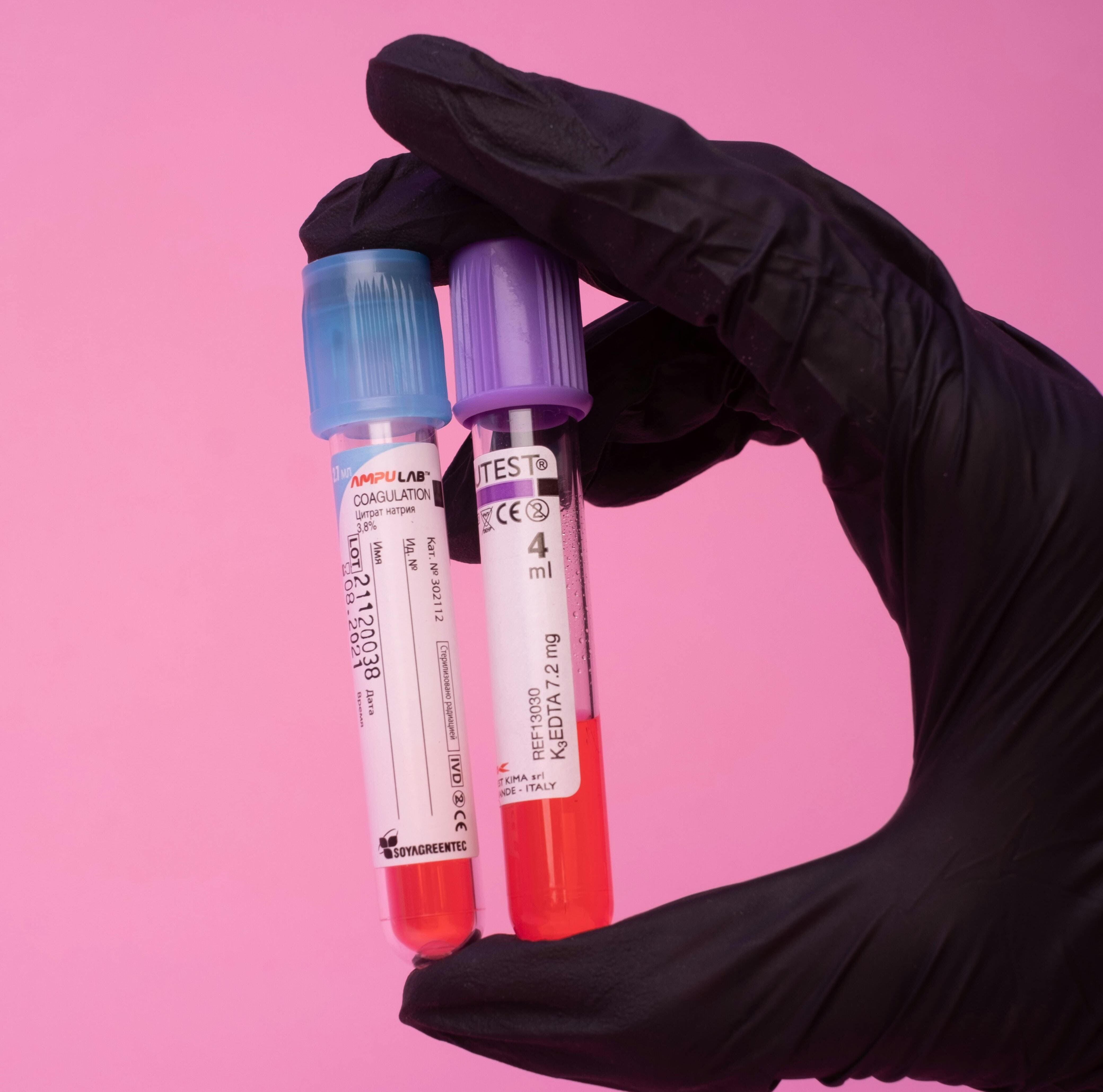 검사 방법과 치료법 차이