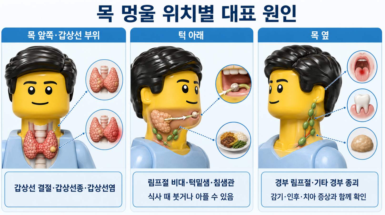 감염 증상과 함께 생긴 목 멍울과 식사 때 턱 아래가 붓는 침샘 문제 비교
