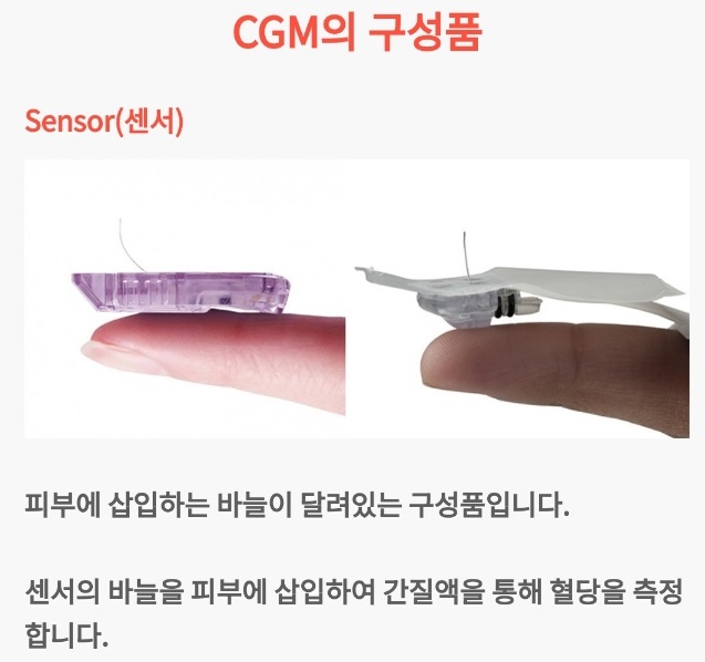 연속혈당측정기