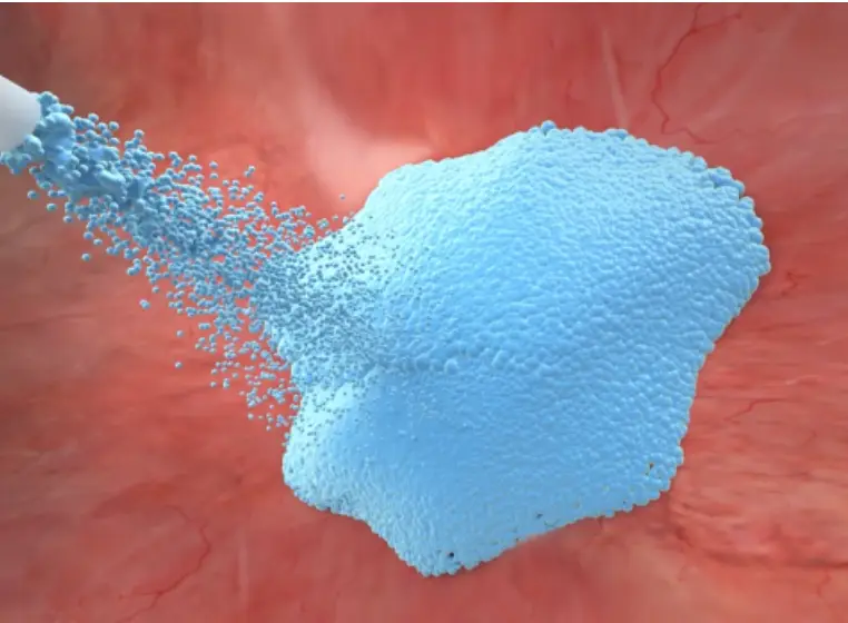 붉은 장기 위 파란색 액체가 뿌려지는 모습