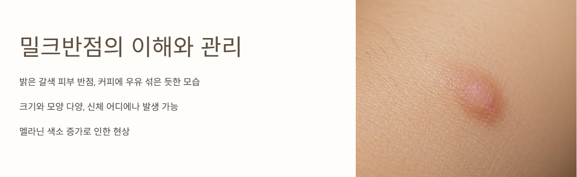 밀크반점이란?