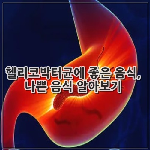 헬리코박터균에 좋은 음식, 나쁜 음식 알아보기