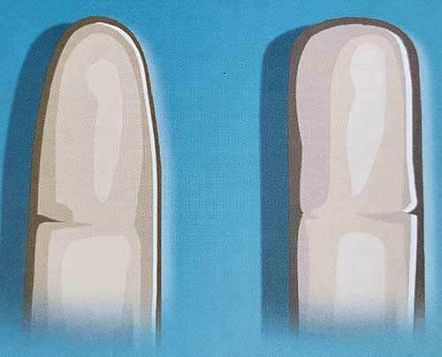 금성, 토성 모양 손가락 끝