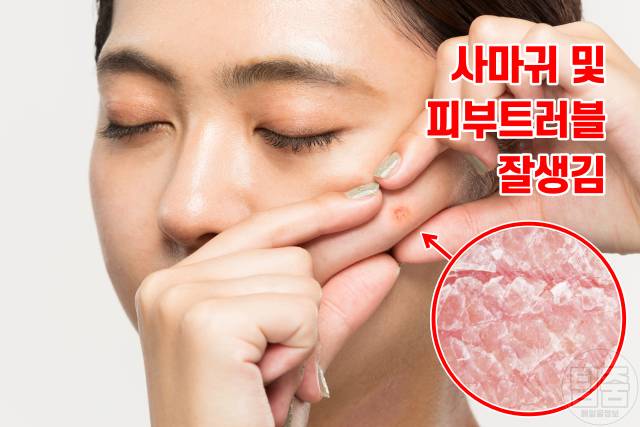 보습에 좋은 음식,보습에 좋은 성분,건조한 피부 관리법