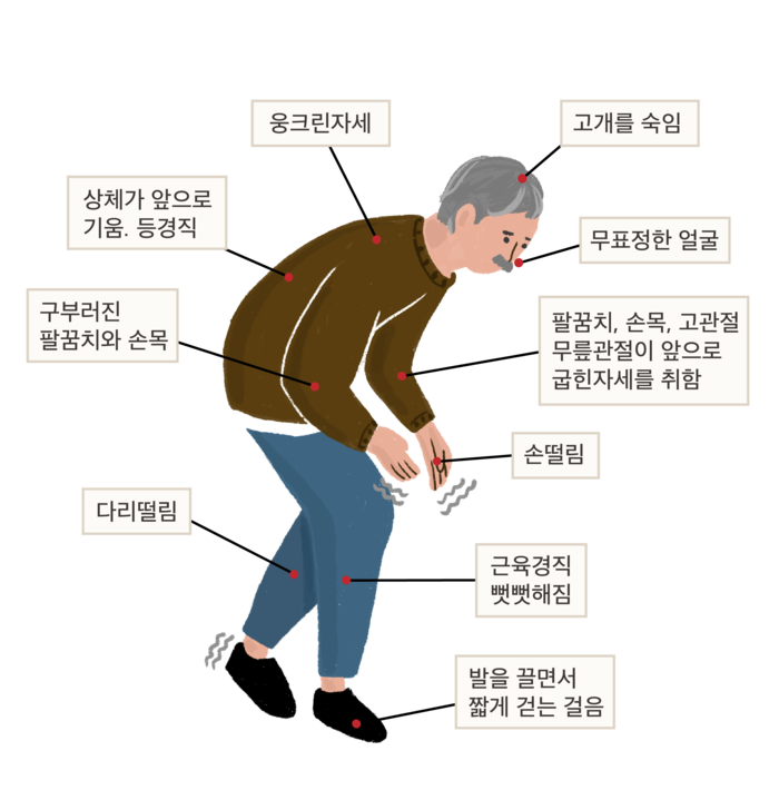 산정특례 대상 질병