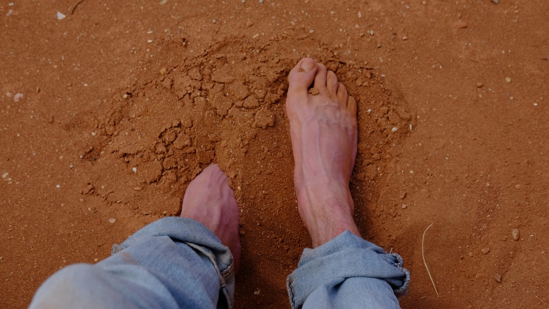 Leprosy