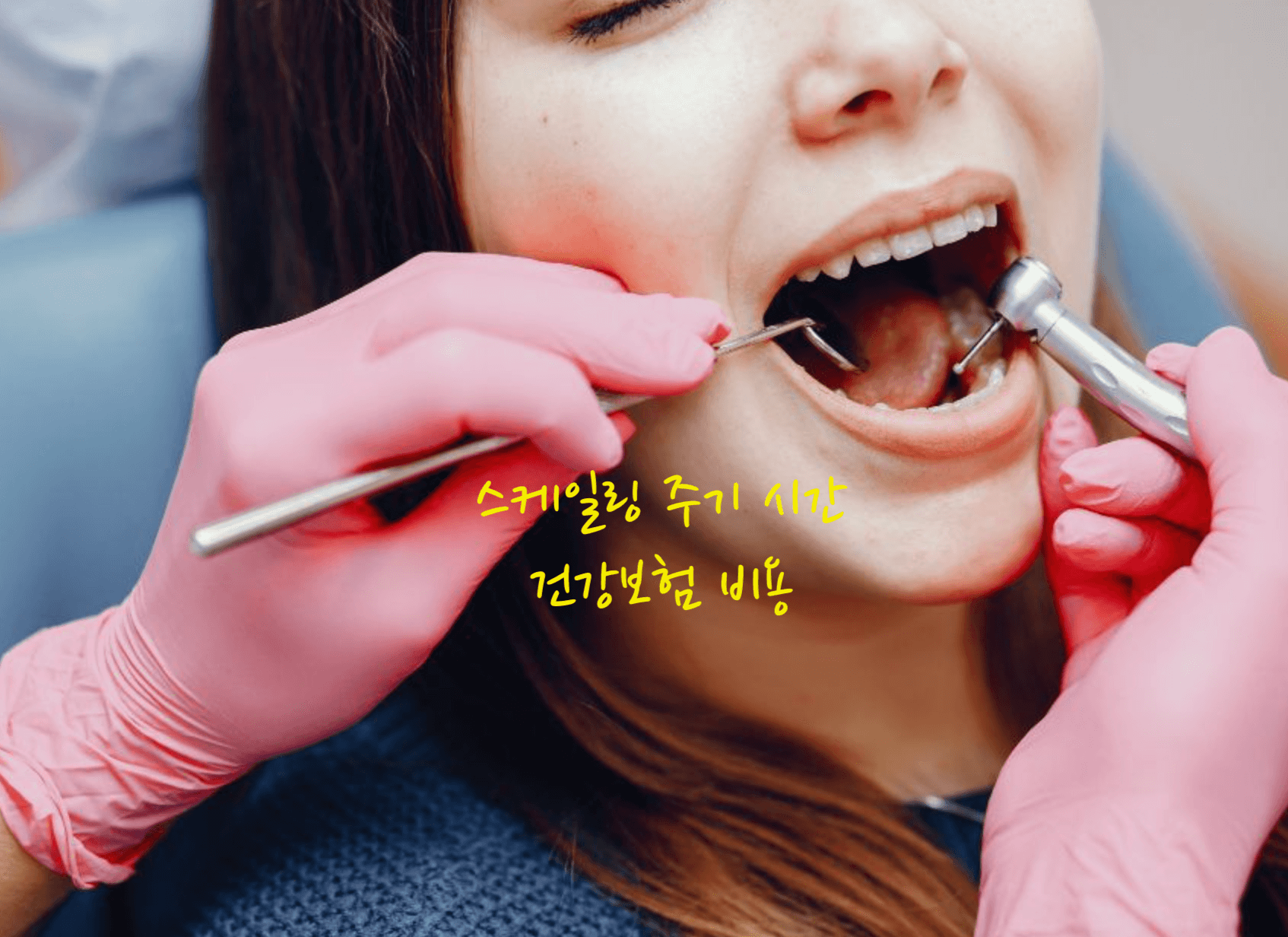 스케일링