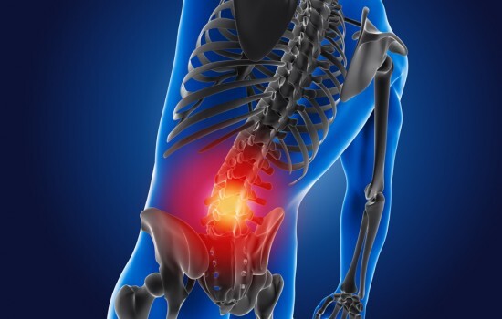 목디스크 수술 후기