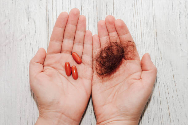 예를 들면, 비오틴, 아연, 셀레늄 같은 성분이 부족하면 모발 성장 주기가 불안정해질 수 있고요. 그래서 요즘은 병원 처방 없이도 영양제를 통해 탈모를 예방하고 관리하려는 분들이 점점 많아지고 있어요. 실제로 꾸준히 복용한 사람들 중엔 효과를 체감했다는 후기가 많아요.