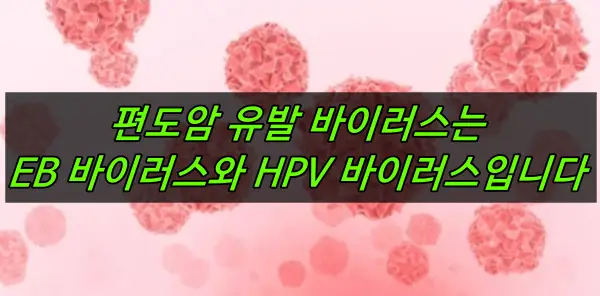 편도암 유발 바이러스