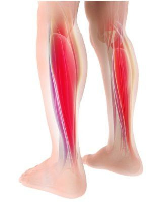 급성구획증후군 원인 증상 치료법, 문근영 유퀴즈 복귀로 보는 골든타임 사수하기