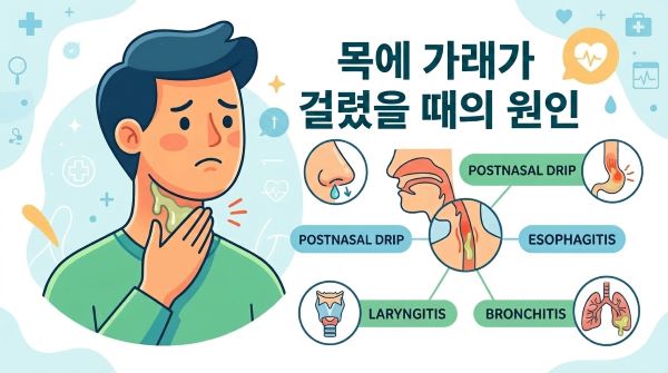 목에 가래가 걸려 불편해 하는 만화 이미지. "목에 가래가 걸렸을 때의 원인"이라는 텍스트가 있는 이미지